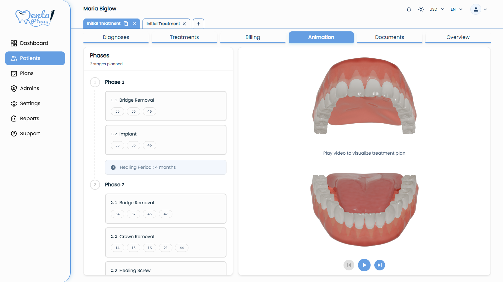 رؤية خطة العلاج (فيديو)